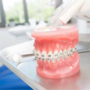 Orthodontic Consultation